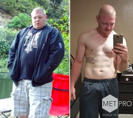 Donny: before and after photos side by side